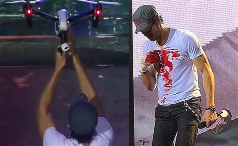 Enrique Iglesias undergoing reconstructive hand surgery